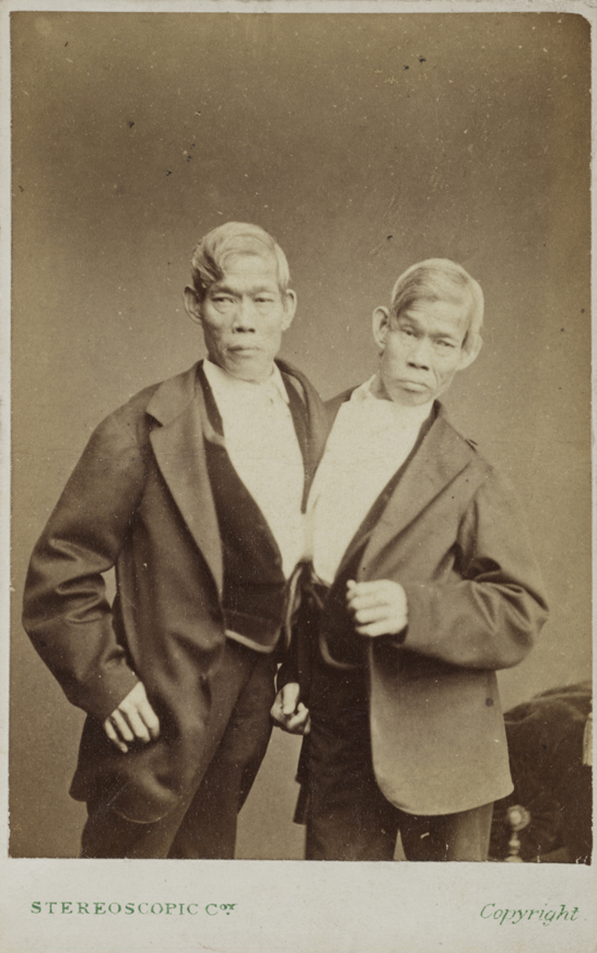 The Siamese Twins, Eng and Chang Bunker, c. 1870, London Stereoscopic & Photographic Company © National Media Museum, Bradford / SSPL. Creative Commns BY-NC-SA