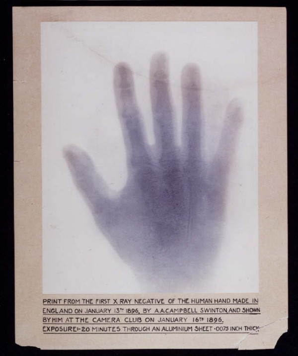 X Ray Hand