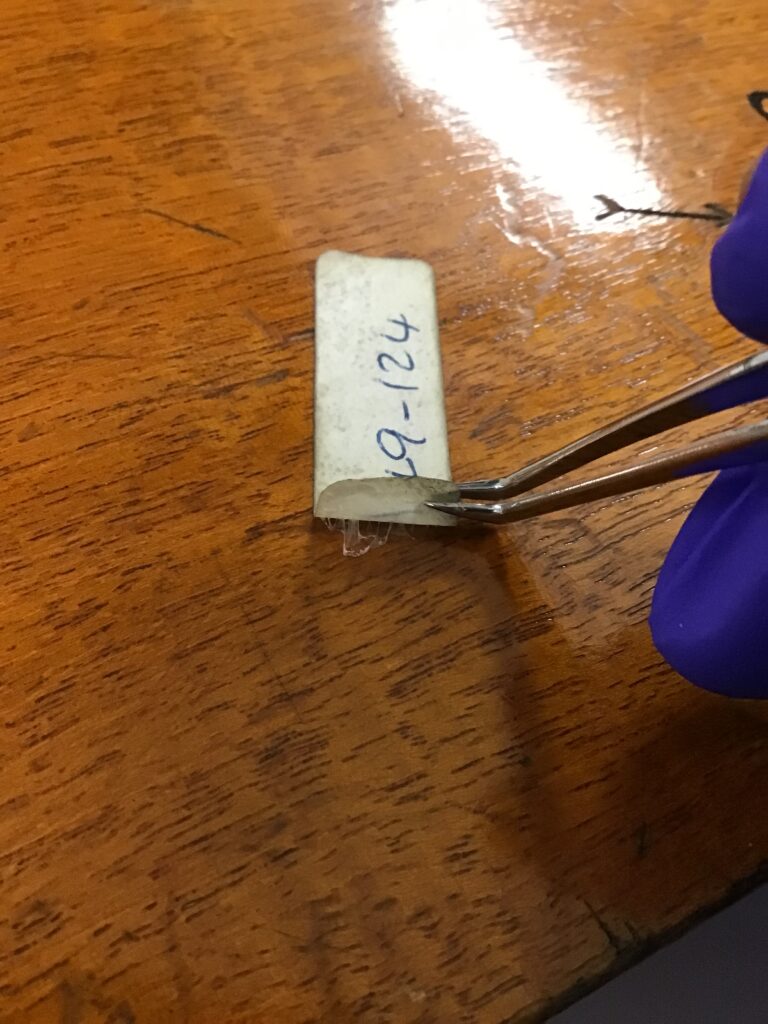 A hand using tweezers to lift the peeling label