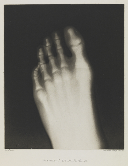 Fuss eines 17 jährigen Jünglings, 1896, Eduard Valenta and Josef Maria Eder, National Media Museum, Bradford / SSPL. Creative Commons BY-NC-SA