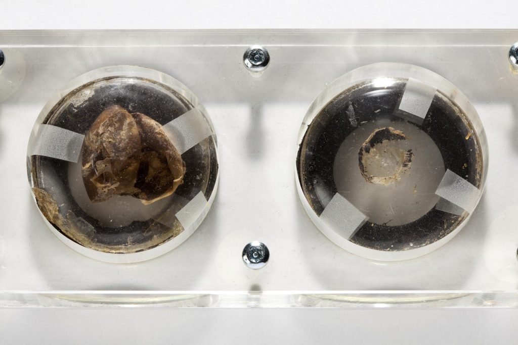 Remains of John Dalton's eyes photographed on a white background