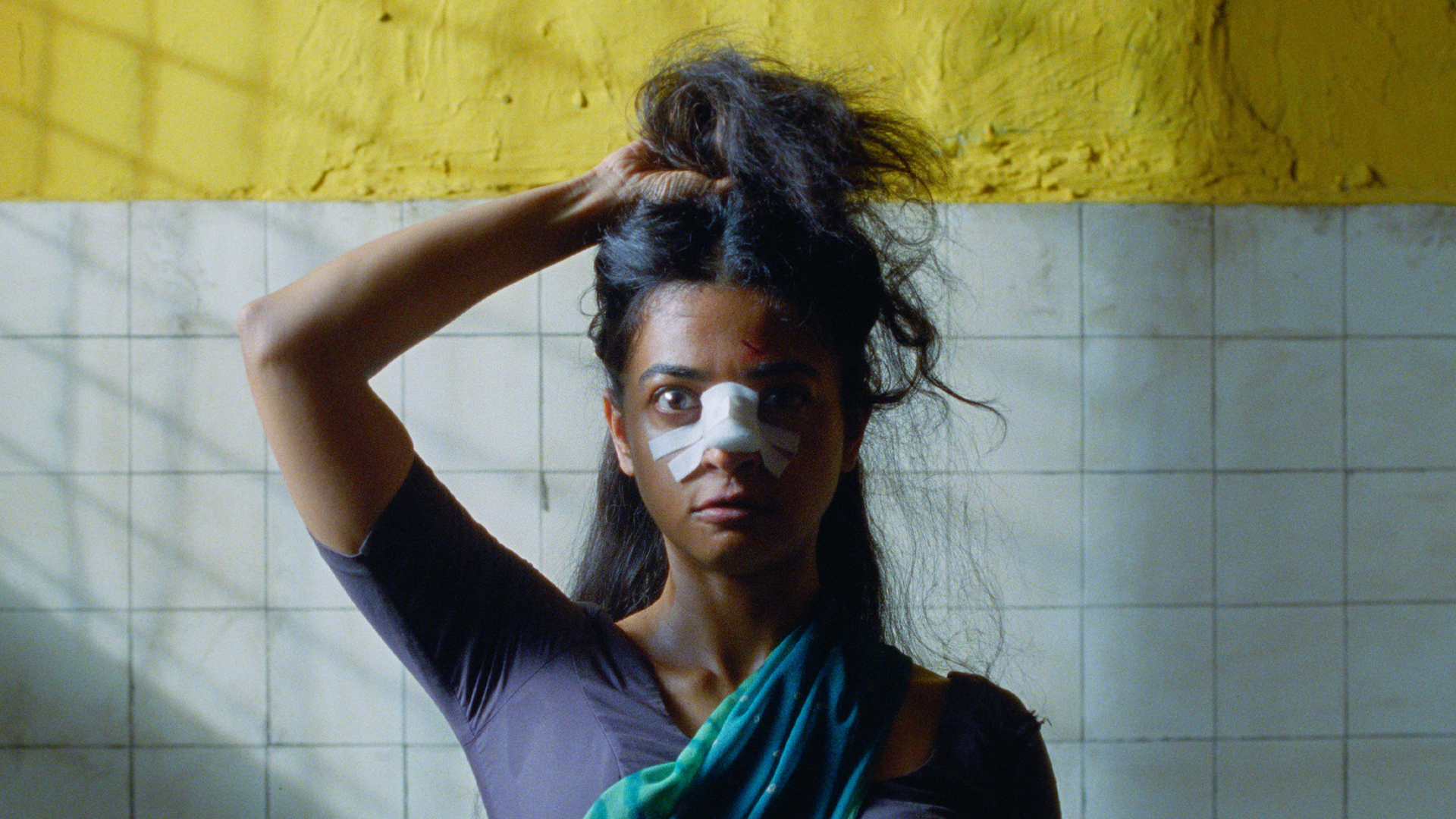 A woman with a bandage across her nose holds her hair up behind her head.